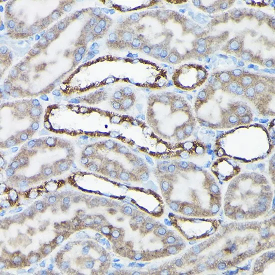IHC-P analysis of rat kidney tissue using GTX32428 AIF antibody. Dilution : 1:50