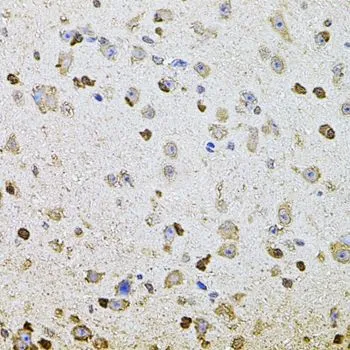 IHC-P analysis of mouse brain tissue using GTX32431 ALDH1A1 antibody. Dilution : 1:100