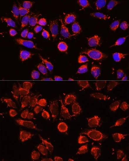 ICC/IF analysis of 293T cells using GTX32434 alpha 2 Macroglobulin antibody. Blue : DAPI Dilution : 1:100