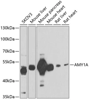 WB analysis of various sample lysates using GTX32440 AMY1A antibody. The signal was developed with ECL plus-Enhanced. Dilution : 1:1000 Loading : 25microg per lane WB analysis of various sample lysates using GTX32440 AMY1A antibody. The signal was developed with ECL plus-Enhanced. Dilution : 1:1000 Loading : 25microg per lane