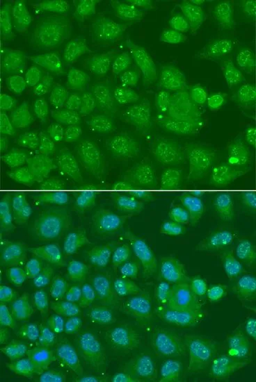 ICC/IF analysis of A549 cells using GTX32445 Annexin A8 like 2 antibody. Blue : DAPI