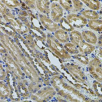 IHC-P analysis of rat kidney tissue using GTX32445 Annexin A8 like 2 antibody. Dilution : 1:100