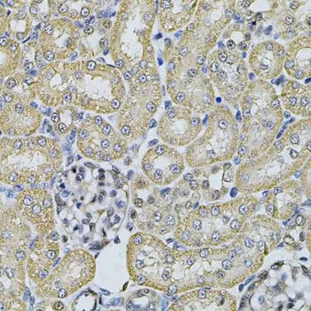 IHC-P analysis of rat kidney tissue using GTX32449 AP2A1 antibody. Dilution : 1:100