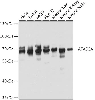 WB analysis of various sample lysates using GTX32458 ATAD3A antibody. Dilution : 1:1000 Loading : 25microg per lane WB analysis of various sample lysates using GTX32458 ATAD3A antibody. Dilution : 1:1000 Loading : 25microg per lane
