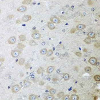 IHC-P analysis of mouse brain tissue using GTX32458 ATAD3A antibody. Dilution : 1:100