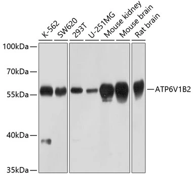 WB analysis of various sample lysates using GTX32461 ATP6V1B2 antibody. Dilution : 1:1000 Loading : 25microg per lane WB analysis of various sample lysates using GTX32461 ATP6V1B2 antibody. Dilution : 1:1000 Loading : 25microg per lane