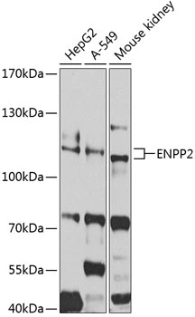 WB analysis of various sample lysates using GTX32462 Autotaxin antibody. Dilution : 1:1000 Loading : 25microg per lane WB analysis of various sample lysates using GTX32462 Autotaxin antibody. Dilution : 1:1000 Loading : 25microg per lane