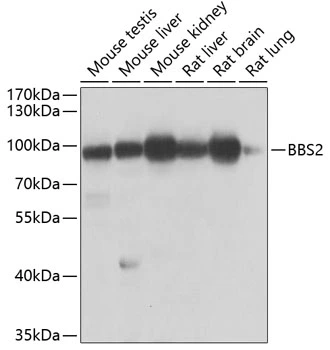 WB analysis of various sample lysates using GTX32466 BBS2 antibody. The signal was developed with ECL plus-Enhanced. Dilution : 1:1000 Loading : 25microg per lane WB analysis of various sample lysates using GTX32466 BBS2 antibody. The signal was developed with ECL plus-Enhanced. Dilution : 1:1000 Loading : 25microg per lane