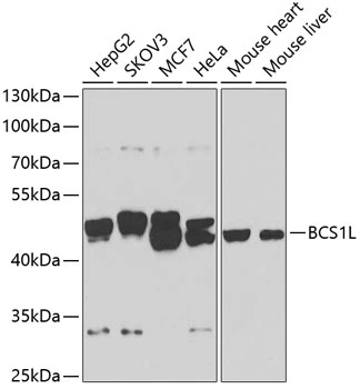WB analysis of various sample lysates using GTX32469 BCS1L antibody. Dilution : 1:1000 Loading : 25microg per lane WB analysis of various sample lysates using GTX32469 BCS1L antibody. Dilution : 1:1000 Loading : 25microg per lane
