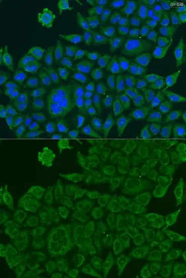 ICC/IF analysis of U2OS cells using GTX32469 BCS1L antibody. Blue : DAPI Dilution : 1:100