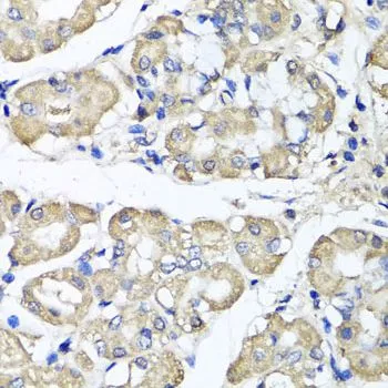 IHC-P analysis of human stomach tissue using GTX32469 BCS1L antibody. Dilution : 1:100