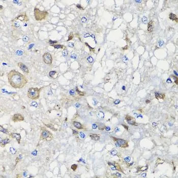 IHC-P analysis of rat brain tissue using GTX32469 BCS1L antibody. Dilution : 1:100