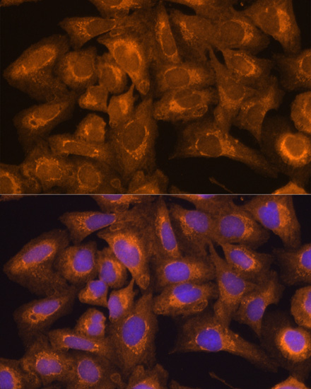 WB analysis of HL-60 cell lysate using GTX32471 Bid antibody. Loading : 25ug per lane