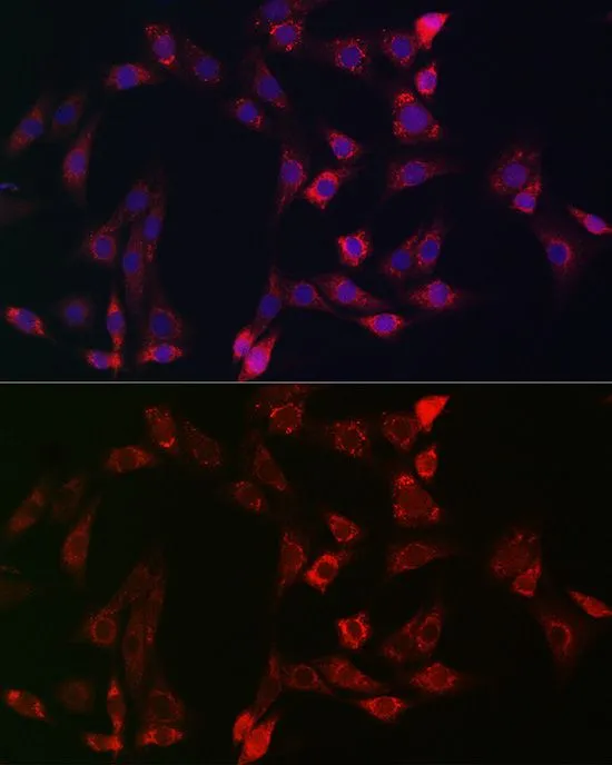 ICC/IF analysis of C6 cells using GTX32471 Bid antibody. Blue : DAPI Dilution : 1:100