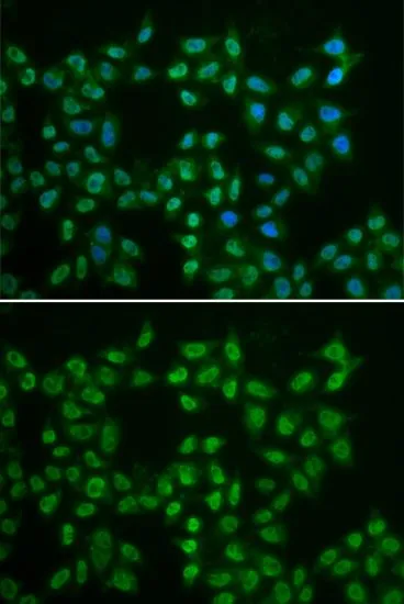 ICC/IF analysis of HeLa cells using GTX32479 BTK antibody. Blue : DAPI ICC/IF analysis of HeLa cells using GTX32479 BTK antibody. Blue : DAPI