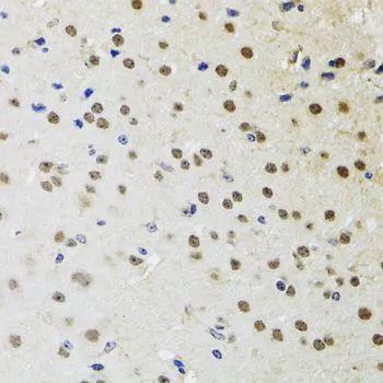 IHC-P analysis of mouse brain tissue using GTX32479 BTK antibody. Dilution : 1:100