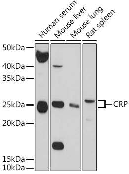 WB analysis of various sample lysates using GTX32481 C Reactive Protein antibody. Dilution : 1:1000 Loading : 25microg per lane WB analysis of various sample lysates using GTX32481 C Reactive Protein antibody. Dilution : 1:1000 Loading : 25microg per lane