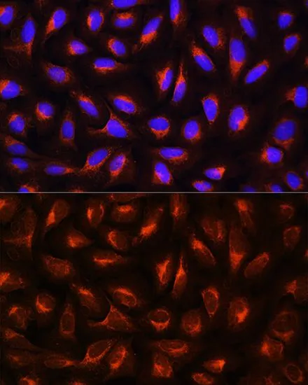 ICC/IF analysis of U2OS cells using GTX32481 C Reactive Protein antibody. Blue : DAPI Dilution : 1:100
