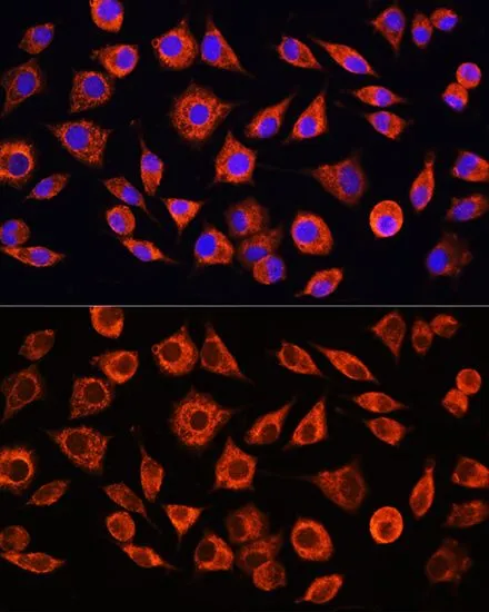 ICC/IF analysis of L929 cells using GTX32481 C Reactive Protein antibody. Blue : DAPI Dilution : 1:100