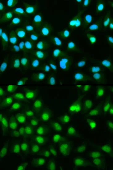 ICC/IF analysis of HeLa cells using GTX32485 Calcineurin A antibody. Blue : DAPI