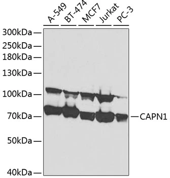 WB analysis of various sample lysates using GTX32486 Calpain 1 antibody. Dilution : 1:1000 Loading : 25microg per lane WB analysis of various sample lysates using GTX32486 Calpain 1 antibody. Dilution : 1:1000 Loading : 25microg per lane
