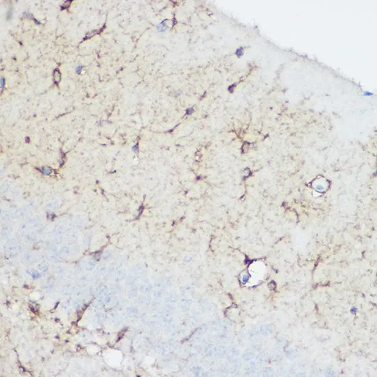IHC-P analysis of mouse heart tissue using GTX32486 Calpain 1 antibody. Dilution : 1:100