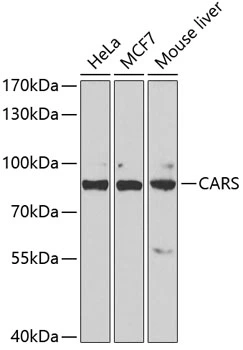 WB analysis of various sample lysates using GTX32489 CARS antibody. Dilution : 1:1000 Loading : 25microg per lane WB analysis of various sample lysates using GTX32489 CARS antibody. Dilution : 1:1000 Loading : 25microg per lane
