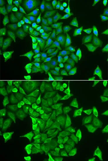 ICC/IF analysis of HeLa cells using GTX32489 CARS antibody. Blue : DAPI
