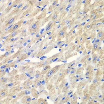 IHC-P analysis of mouse heart tissue using GTX32489 CARS antibody. Dilution : 1:100