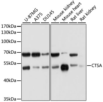 WB analysis of various samples using GTX32490 Cathepsin A antibody. Dilution : 1:1000 Loading : 25ug per lane