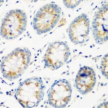 IHC-P analysis of human colon tissue using GTX32491 Cathepsin G antibody. Dilution : 1:100