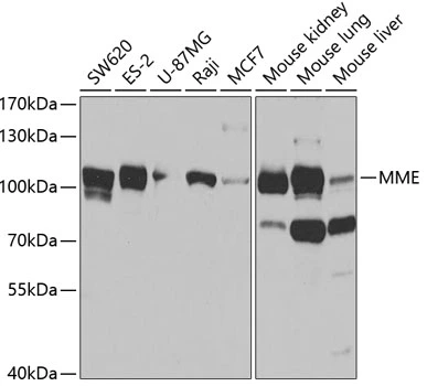 WB analysis of various sample lysates using GTX32493 CD10 antibody. Dilution : 1:1000 Loading : 25microg per lane WB analysis of various sample lysates using GTX32493 CD10 antibody. Dilution : 1:1000 Loading : 25microg per lane