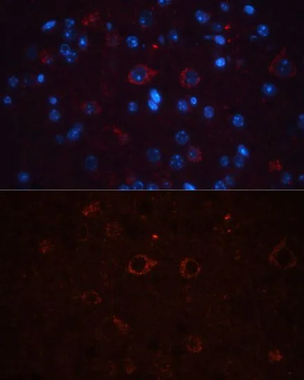 IHC-P analysis of mouse brain tissue using GTX32508 CD90 antibody. Blue : DAPI Dilution : 1:100