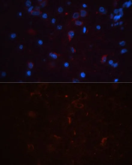 IHC-P analysis of rat brain tissue using GTX32508 CD90 antibody. Blue : DAPI Dilution : 1:100