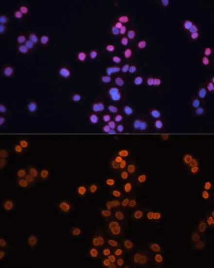 ICC/IF analysis of HT-29 cells using GTX32513 CDX2 antibody. Blue : DAPI Dilution : 1:100