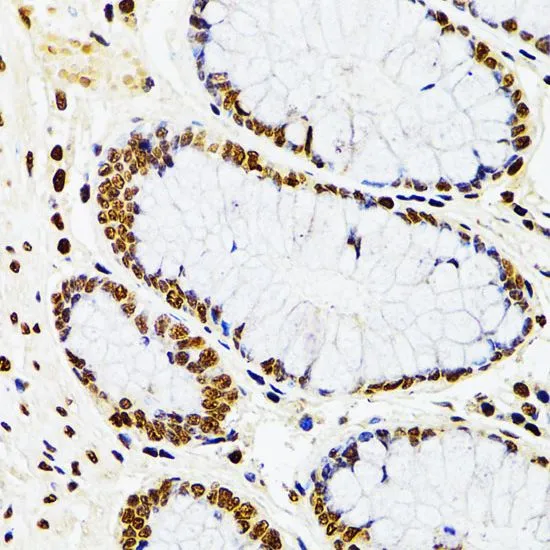 IHC-P analysis of human rectum tissue using GTX32513 CDX2 antibody. Dilution : 1:100