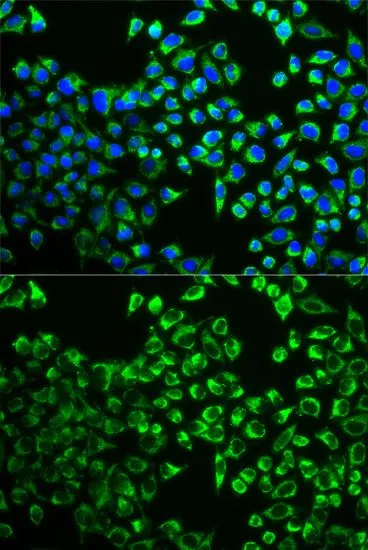 ICC/IF analysis of MCF7 cells using GTX32524 Citrate synthase antibody. Blue : DAPI