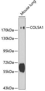WB analysis of mouse lung tissue lysate using GTX32530 COL5A1 antibody. Dilution : 1:500 Loading : 25microg per lane WB analysis of mouse lung tissue lysate using GTX32530 COL5A1 antibody. Dilution : 1:500 Loading : 25microg per lane