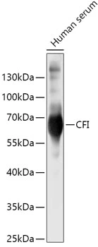 WB analysis of human serum lysate using GTX32531 Factor I antibody. Dilution : 1:500 Loading : 25microg per lane WB analysis of human serum lysate using GTX32531 Factor I antibody. Dilution : 1:500 Loading : 25microg per lane