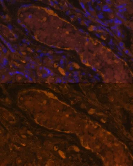 IHC-P analysis of human placenta tissue using GTX32531 Factor I antibody. Blue : DAPI Dilution : 1:100