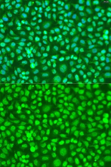 ICC/IF analysis of U2OS cells using GTX32534 COQ7 antibody. Blue : DAPI Dilution : 1:100 ICC/IF analysis of U2OS cells using GTX32534 COQ7 antibody. Blue : DAPI Dilution : 1:100