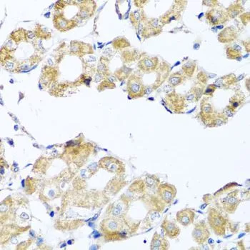 IHC-P analysis of human stomach tissue using GTX32534 COQ7 antibody. Dilution : 1:100