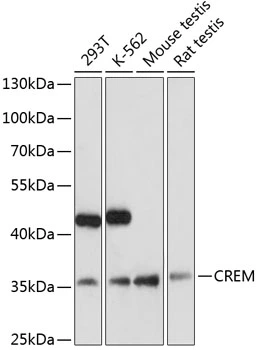 WB analysis of various sample lysates using GTX32538 CREM antibody. Dilution : 1:3000 Loading : 25microg per lane WB analysis of various sample lysates using GTX32538 CREM antibody. Dilution : 1:3000 Loading : 25microg per lane
