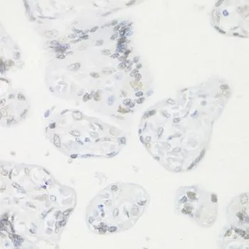 IHC-P analysis of human placenta tissue using GTX32538 CREM antibody. Dilution : 1:100
