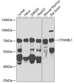 WB analysis of various sample lysates using GTX32543 CTNNBL1 antibody. Dilution : 1:1000 Loading : 25microg per lane WB analysis of various sample lysates using GTX32543 CTNNBL1 antibody. Dilution : 1:1000 Loading : 25microg per lane