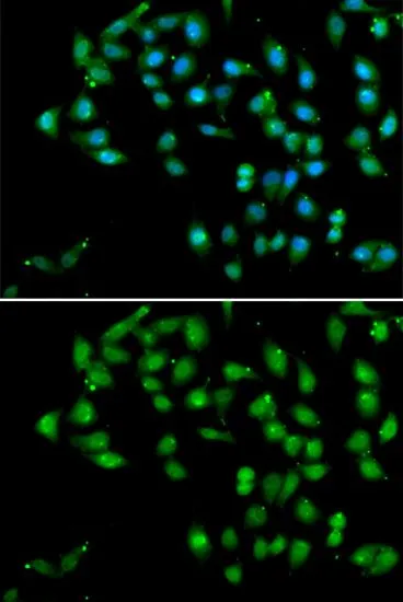 ICC/IF analysis of U2OS cells using GTX32543 CTNNBL1 antibody. Blue : DAPI