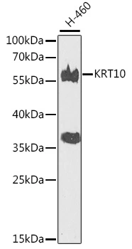 WB analysis of H460 cell lysate using GTX32547 Cytokeratin 10 antibody. Dilution : 1:500 Loading : 25microg per lane WB analysis of H460 cell lysate using GTX32547 Cytokeratin 10 antibody. Dilution : 1:500 Loading : 25microg per lane