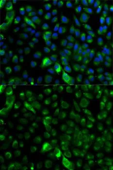 ICC/IF analysis of A549 cells using GTX32548 Cytokeratin 17 antibody. Blue : DAPI
