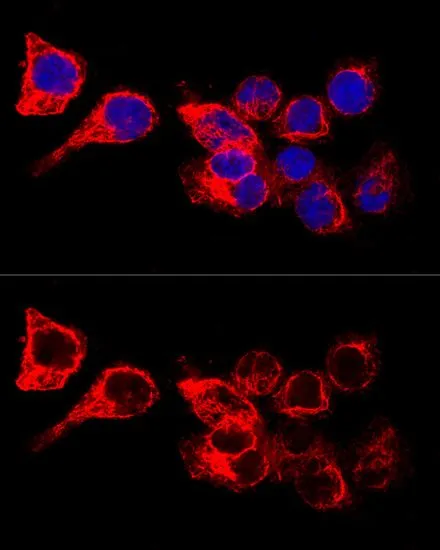 ICC/IF analysis of HeLa cells using GTX32548 Cytokeratin 17 antibody. Blue : DAPI Dilution : 1:200