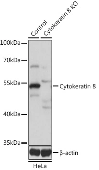 WB analysis of normal (control) and knockout (KO) HeLa cell lysate using GTX32549 Cytokeratin 8 antibody. Dilution : 1:1000 Loading : 25microg per lane WB analysis of normal (control) and knockout (KO) HeLa cell lysate using GTX32549 Cytokeratin 8 antibody. Dilution : 1:1000 Loading : 25microg per lane